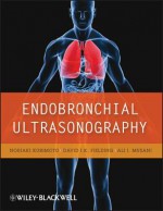 Endobronchial Ultrasonography - Noriaki Kurimoto, David Fielding, Ali Musani