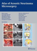 Atlas of Acoustic Neurinoma Microsurgery - Mario Sanna, Fernando Mancini