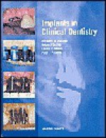 Implants in Clinical Dentistry - Richard M Palmer, Richard M. Palmer, Richard Palmer, Paul Palmer, Brian Smith, Richard M Palmer, Paul J Palmer, Brian J. Smith