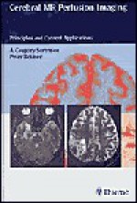 Cerebral MR Perfusion Imaging: Book + CD-ROM Set: Principles and Current Applications - A. Sorensen, Peter Reimer