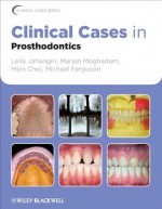 Clinical Cases in Prosthodontics (Clinical Cases (Dentistry)) - Leila Jahangiri, Marjan Moghadam, Mijin Choi, Michael Ferguson