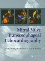 Mitral Valve Transesophageal Echocardiography - Martin St. John Sutton, Alan R. Maniet