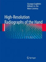 High-Resolution Radiographs of the Hand - Giuseppe Guglielmi, Wilfred C.G. Peh, Mario Cammisa