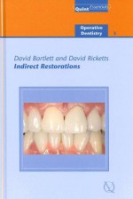 Indirect Restorations - David Bartlett, David Ricketts, Nairn Wilson