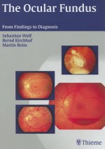 The Ocular Fundus: From Findings to Diagnosis - Sebastian Wolf, Martin Reim, Bernd Kirchhof