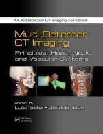 Multi-Detector CT Imaging: Principles, Head, Neck, and Vascular Systems - Luca Saba, Jasjit S. Suri