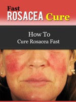 Fast Rosacea Cure - How To Cure Rosacea Fast (Rosacea Treatments, Rosacea Diet & Rosacea Remedies) - Ben Taylor