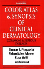 Color Atlas & Synopsis of Clinical Dermatology - Thomas Bernard Fitzpatrick, Richard Allen Johnson