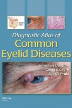 Diagnostic Atlas of Common Eyelid Diseases - Jonathan J. Dutton