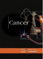 Cancer - Belinda Mooney