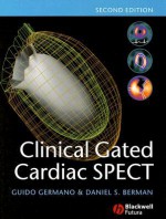 Clinical Gated Cardiac SPECT - Guido Germano, Daniel Berman