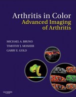 Arthritis in Color: Advanced Imaging of Arthritis - Michael Bruno