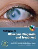 Techniques in Glaucoma Diagnosis and Treatment [With DVD ROM] - Ashok Garg, Jes N. Mortensen, Giorgio Marchini