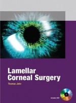 Lamellar Corneal Surgery - Thomas John