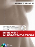 Breast Augmentation (McGraw-Hill Plastic Surgery Atlas) - William Adams