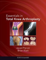 Essentials in Total Knee Arthroplasty - Javad Parvizi, Brian Klatt