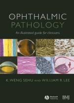 Ophthalmic Pathology: An Illustrated Guide for Clinicans [With CDROM] - Weng K Sehu, William Lee, K. Weng Sehu