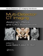 Multi-Detector CT Imaging: Abdomen, Pelvis, and CAD Applications - Luca Saba, Jasjit S Suri