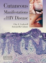 Cutaneous Manifestations of HIV Disease - Clay J. Cockerell