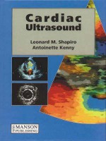 Cardiac Ultrasound - Leonard M. Shapiro, Antoinette Kenny