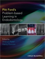 Pitt Ford's Problem-Based Learning in Endodontology - Thomas R. Pitt Ford, Shanon Patel, Markus Haapasalo