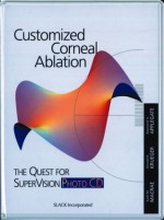 Customized Corneal Ablation: The Quest for SuperVision Photo CD - Scott MacRae, Scott MacRae, Ronald Krueger