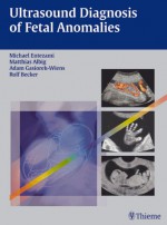 Ultrasound Diagnosis of Fetal Anomalies - Michael Entezami, Rolf Becker, Adam Gasiorek-Wiens