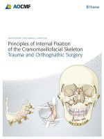 Principles of Internal Fixation of the Craniomaxillofacial Skeleton - Michael Ehrenfeld, Paul N Manson