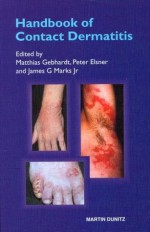 Handbook of Contact Dermatitis - Matthias Gebhardt, Peter Elsner, James G. Marks Jr.