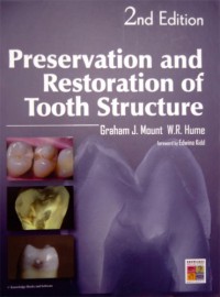 Preservation And Restoration Of Tooth Structure - Graham J. Mount, W.R. Hume