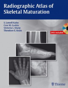 Radiographic Atlas of Skeletal Maturation - S. Lowell Kahn, Christopher M. Gaskin, Victoria L. Sharp, Theodore E. Keats, Bing Li