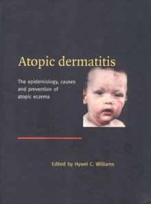 Atopic Dermatitis: The Epidemiology, Causes and Prevention of Atopic Eczema - Hywel C. Williams