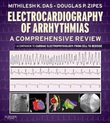 Electrocardiography of Arrhythmias: A Comprehensive Review: A Companion to Cardiac Electrophysiology: Expert Consult - Online - Mithilesh Kumar Das, Douglas P. Zipes