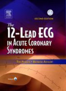 The 12-Lead ECG in Acute Coronary Syndromes [With CDROM and Pocket Reference] - C.V. Mosby Publishing Company, Barbara Aehlert