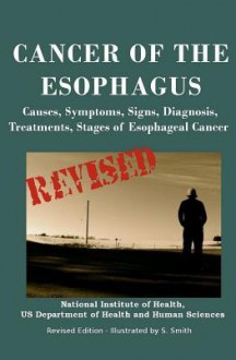 Cancer of the Esophagus - National Institutes of Health, National Cancer Institute