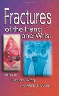 Fractures of the Hand and Wrist - David C. Ring, Mark Cohen