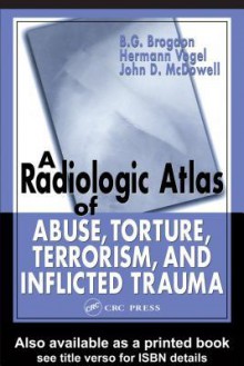 Radiologic Atlas Of Abuse, Torture, Terrorism, And Inflicted - Hermann Wilhelm Vogel, Hermann Vogel, John D. McDowell, B.G. Brogdon