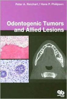 Odontogenic Tumors and Allied Lesions: - Peter A. Reichart, Hans Peter Philipsen