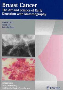 Breast Cancer - The Art and Science of Early Detection with Mammography: Perception, Interpretation, Histopathologic Correlation - Laszlo Tabar, Tibor Tot, Peter Dean, Peter B. Dean