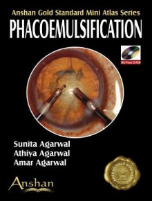 Mini Atlas of Phacoemulsification - Amar Agarwal, Sunita Agarwal, Athiya Agarwal