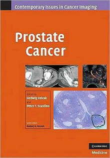 Prostate Cancer - Peter T. Scardino