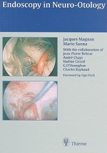 Endoscopy in Neuro-Otology - Jacques Magnan, Mario Sanna