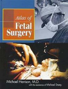 Atlas Of Fetal Surgery - Michael Harrison