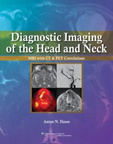 Diagnostic Imaging of the Head and Neck - Anton N. Hasso