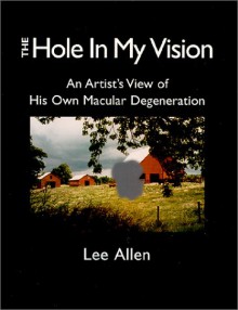 The Hole in My Vision: Watching My Own Age-Related Macular Degeneration - Lee Allen