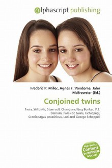 Conjoined Twins - Agnes F. Vandome, John McBrewster, Sam B Miller II