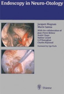 Endoscopy of Neurootology - Jacques Magnan, M. Sanna