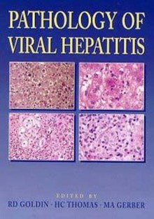 Pathology Of Viral Hepatitis - R. D. Goldin, H.C. Thomas, M. A. Gerber