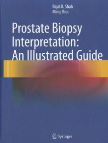 Prostate Biopsy Interpretation: An Illustrated Guide - Rajal B. Shah, Ming Zhou