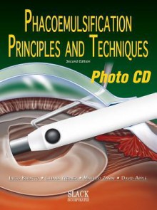 Phacoemulsification: Principles and Techniques, Photo CD - Lucio Buratto, David J. Apple, Maurizio Zanini, Liliana Werner